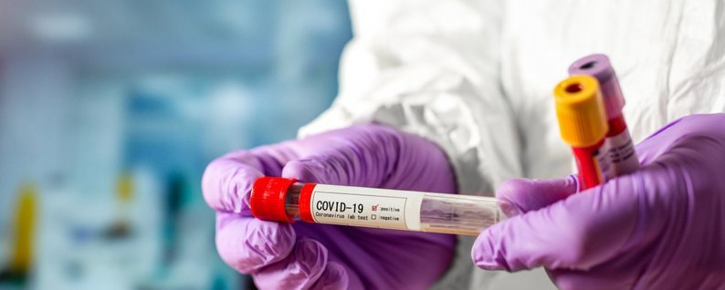  ������� ������� ���� ���� ������ 