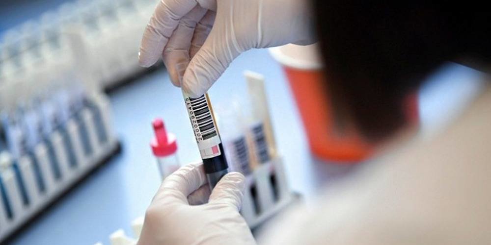  ������� covid-19 ���� ������ ����� 