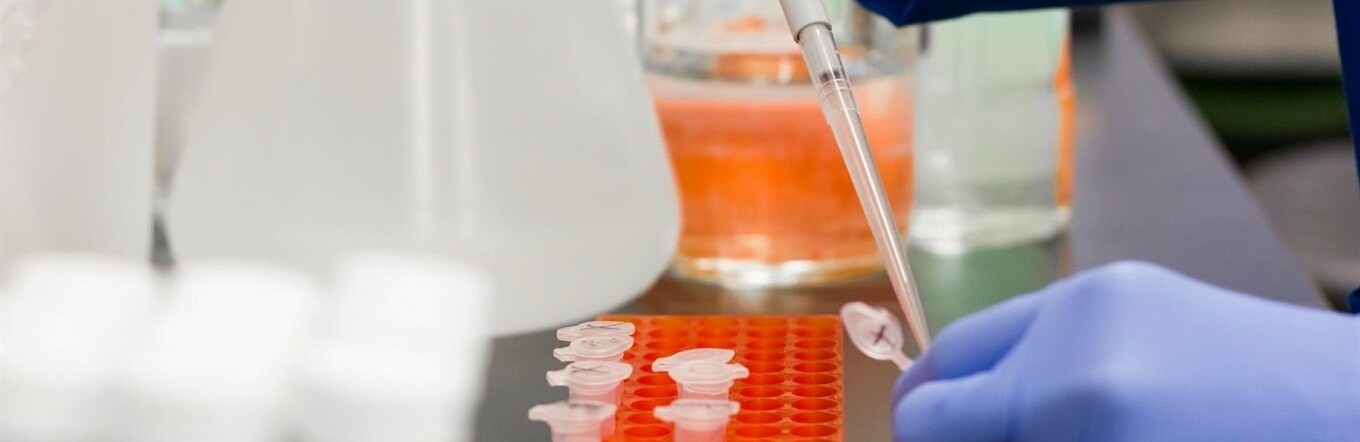  ������ ������� covid-19 ���� ������ ����� 