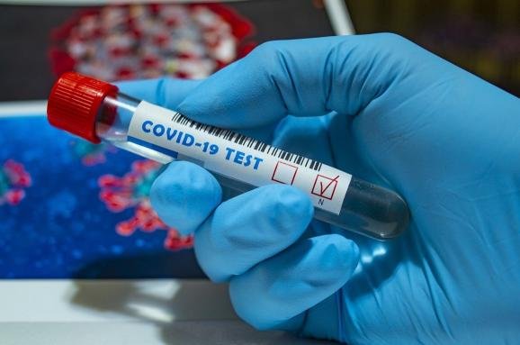 218 нових випадків COVID-19 у Донецькій області. Статистика за минулу добу 